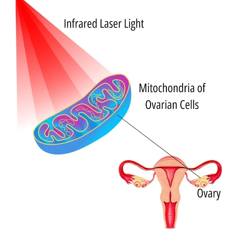 LLLT and Its Impact on Granulosa Cells